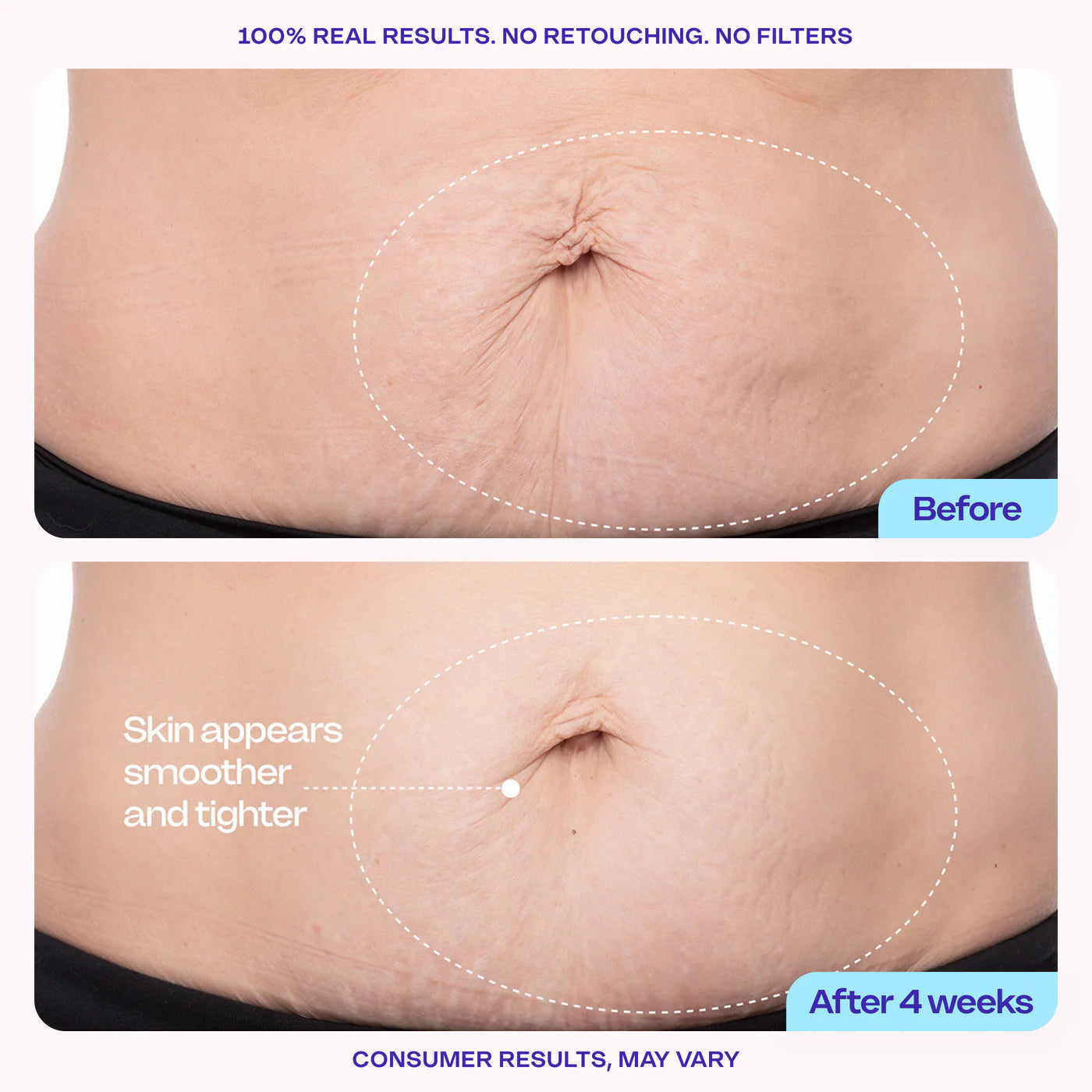 GoPure Belly Cream (Tighten & Smooth Stretch Marks)