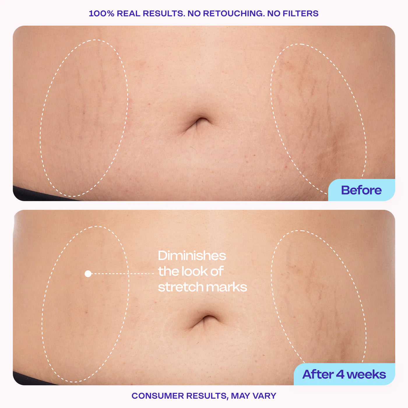 GoPure Belly Cream (Tighten & Smooth Stretch Marks)