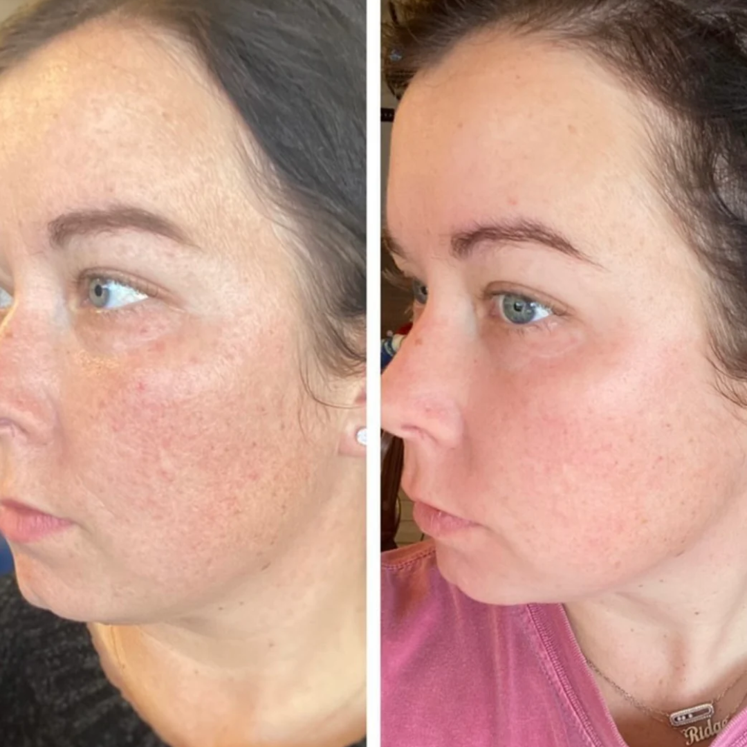 Honey Beef Tallow Balm (Face & Body Moisturizer)